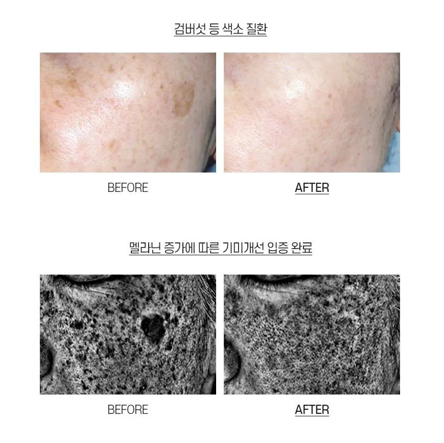 MEDI-PEEL Melanon X Cream 30ml - Glowii Beauty