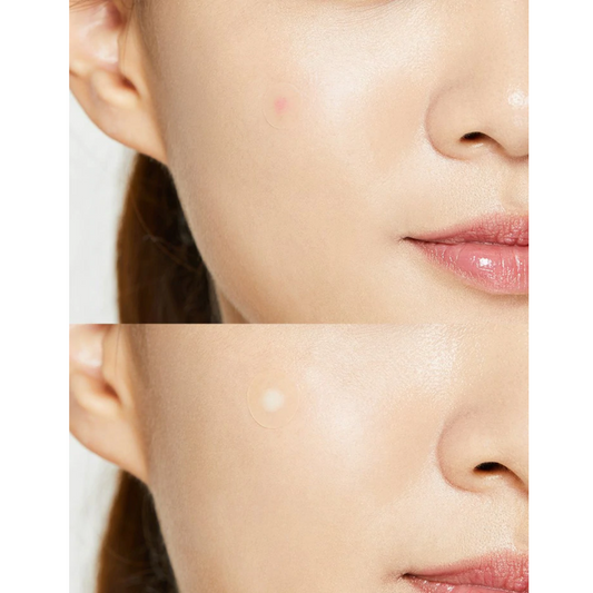 COSRXAcne Pimple Master Patches (24 Patches)  - Glowii Beauty